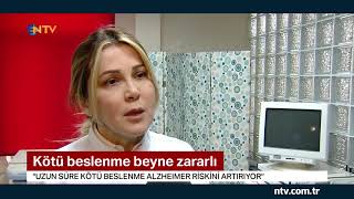 İşlenmiş gıdalar beyne zararlı