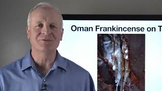 GC-MS 1: Understanding GC-MS Analysis of Essential Oils