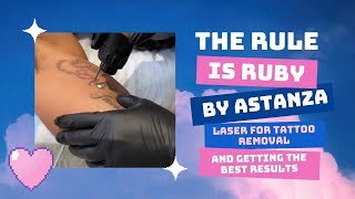 THE RULE IS RUBY BY ASTANZA LASER FOR TATTOO REMOVAL AND GETTING THE BEST RESULTS | Dr. Jason Emer