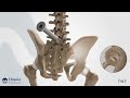 Minimally Invasive Sacroiliac Joint Fusion - SI Joint Fusion - CPM Patient Testimonial