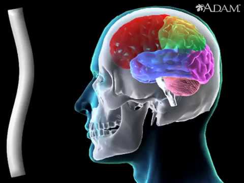 How Concussions Affect The Brain Animation - Traumatic Brain Injury ...