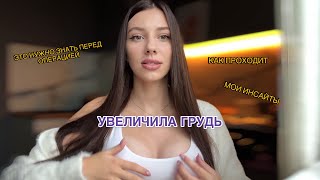 Как я сделала грудь / Маммопластика, восстановление, нюансы