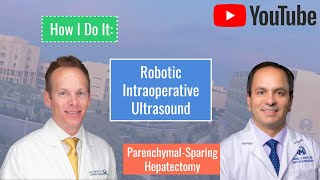 How I Do It: Robotic Intraoperative Ultrasound for Parenchymal Sparing Hepatectomy