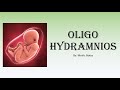 [O&G] Oligohydramnios - causes, investigations, management, complications