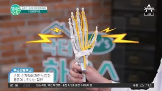 [닥터하우스] 갑자기 손이 저릿저릿하다?! 방치하면 손을 아예 못 쓸 수 있다! #손목터널증후군 | 행복한 아침 1371 회