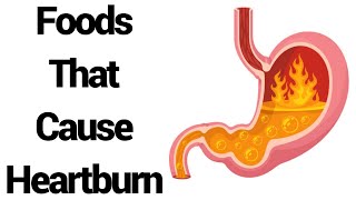 9 Foods That Cause Heartburn