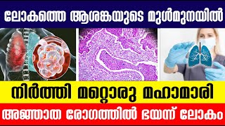 ലോകത്തെ ആശങ്കയുടെ മുള്‍മുനയില്‍ നിര്‍ത്തി മറ്റൊരു മഹാമാരി|Worldnews|Internationalnews|Bnnews|