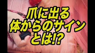 【雑学】爪に出る体からのサイン無視してませんか？