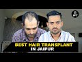 Best Hair Transplant in Jaipur: Results & Cost Breakdown | IFT Hair Science