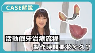 為什麼製作活動假牙要來診所那麼多次？︱活動假牙製作流程︱療程分享