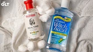 5 Surprising Uses Of Witch Hazel Every Woman Should Know