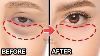 8mins Eye Bags Removal Exercise \u0026 Massage You Must Do | Eye Wrinkles, Dark Circles Under Eyes