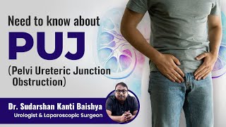 Everything you need to know about PUJ Pelvi Ureteric Junction Obstruction |  Pelvi Ureteric Junction