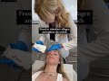 fraxel to tighten the eyelids over40 antiaging skintightening skincare