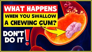 What happens if you swallow chewing gum? Is swallowing chewing gum bad for you? - Don't do it!