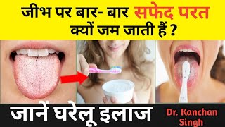 जीभ पर मैल जमना / white coating on tongue/जीभ पर सफेद परत का इलाज /Dr. Kanchan Singh