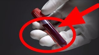 How to BEAT THE STEROIDS / DRUG TEST : it ACTUALLY WORKS / ALPHA STRENGTH