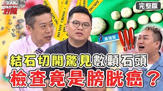 體內驚見「數顆大石頭」！男子結石血尿...切開發現是膀胱癌？愛吃這些食物罹乳癌⬆67%？【#醫師好辣】20220715 完整版  診間怪奇物語   EP1373 徐乃麟 鄭丞傑 陳榮堅