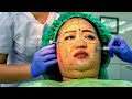 Girl Gets Plastic Surgery For Attention, But The Outcome Is Unexpected