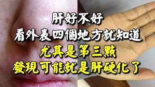 肝好不好，看外表四個地方就知道，尤其是第三點，發現可能就是肝硬化了！