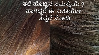 ತಲೆ ಹೊಟ್ಟಿನ ಸಮಸ್ಯೆಗೆ ಉತ್ತಮ ಮನೆಮದ್ದು|Best home remedi for dandruff|How to treat dandruff at home