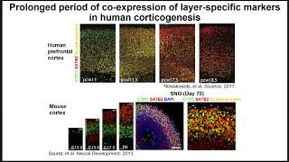 KGRI Lecture Series - Engineering human brain organoids for modeling brain development and injury