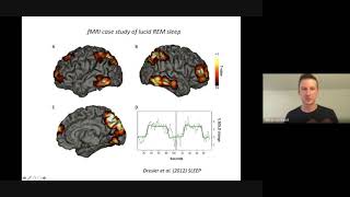 Tech for Dreaming — Benjamin Baird, Ph.D. — The Cognitive Neuroscience of Lucid Dreaming - SEP 2021