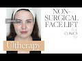 What is Ultherapy? Get face lift results without the surgery #shorts