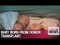 First baby born from uterus transplanted from dead donor about to celebrate 1st birthday