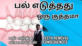 பல் எடுத்தால் என்ன விளைவுகள் உண்டாகும் / 𝐂𝐨𝐧𝐬𝐞𝐪𝐮𝐞𝐧𝐜𝐞𝐬 𝐨𝐟 𝐧𝐨𝐭 𝐫𝐞𝐩𝐥𝐚𝐜𝐢𝐧𝐠 𝐦𝐢𝐬𝐬𝐢𝐧𝐠 𝐭𝐞𝐞𝐭𝐡 𝐢𝐧 𝐭𝐚𝐦𝐢𝐥