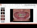 Digital Smile Design - Christian Coachman & Livio Yoshinaga - PART 1/4