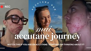 WATCH THIS BEFORE/ DURING ACCUTANE! tips, products, mental health, side effect and more