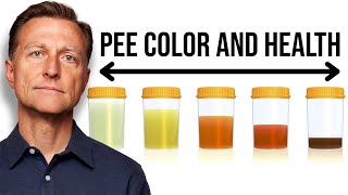 What Your URINE COLOR Says about Your Health