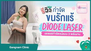 รีวิวเลเซอร์กำจัดขนรักแร้ ด้วย Diode Laser 3 พลังงาน ที่ Gangnam Clinic