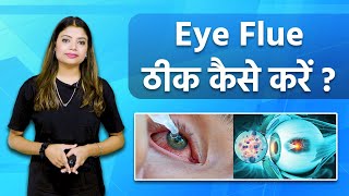 Eye Flu यानि Conjunctivitis को कैसे ठीक करें? कैसे करें इसका घरेलू इलाज? | Eye Flu Thik Kaise Karein