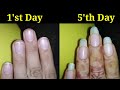 only 1 ingredient || How to grow nails fast || How to grow Nails in 5 days ||