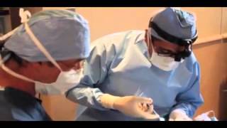 Dr. Rizk Explains Septoplasty Surgery