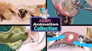 [ASMR] Removal of navel stones, ingrown toenails, ear cleaning, eye stye treatment animation asmr