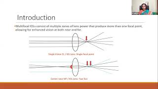 Multifocal IOLs optical principles, types, advantages and disadvantages, patient selection criteria