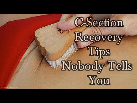 5 C-Section Recovery Tips That Nobody Ever Tells You! #NaturalRemedies 5 C-Section Recovery Tips That Nobody Ever Tells You! #NaturalRemedies