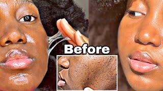 One Week of FLAXSEED GEL on My Face Cleared my TEXTURED Skin & Dark Spots *SHOCKING RESULTS*