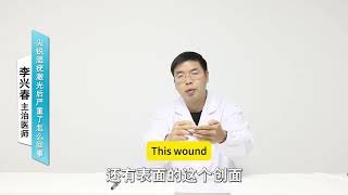 尖锐湿疣激光治疗后严重了是怎么回事/laser treatment   /become more serious