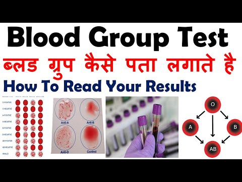 Blood Group Test | Procedure | ब्लड ग्रुप कैसे पता लगाते है | ABO | RH ...