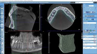 Working with panoramic view in Planmeca Romexis 3D module