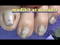 BEST  PAINLESS NAIL REPAIR METHOD