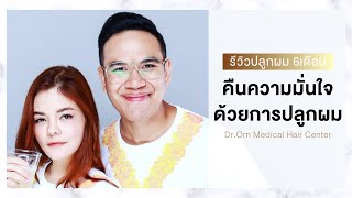 ปลูกผมชีวิตเปลี่ยนคืนความมั่นใจที่ รีวิวปลูกผมDr.Orn Clinic