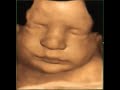 perfect 33 week baby in 3d 4d u0026 hdlive ultrasound .. a new conception ultrasound studio in ma