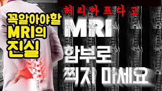 MRI 부작용, MRI 함부로 찍으면 안되는 3가지 이유