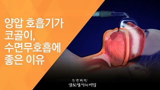 양압 호흡기가 코골이, 수면무호흡에 좋은 이유 - (2010.9.30_345회 방송)_전신질환을 부르는 수면호흡장애