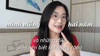 10 điều mình ước mình biết trước khi niềng răng 🦷